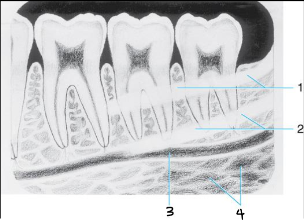 <ol><li><p>external oblique ridge</p></li><li><p>mylohyoid ridge or internal oblique ridge</p></li><li><p>mandibular canal</p></li><li><p>submandibular fossa </p></li></ol><p></p>