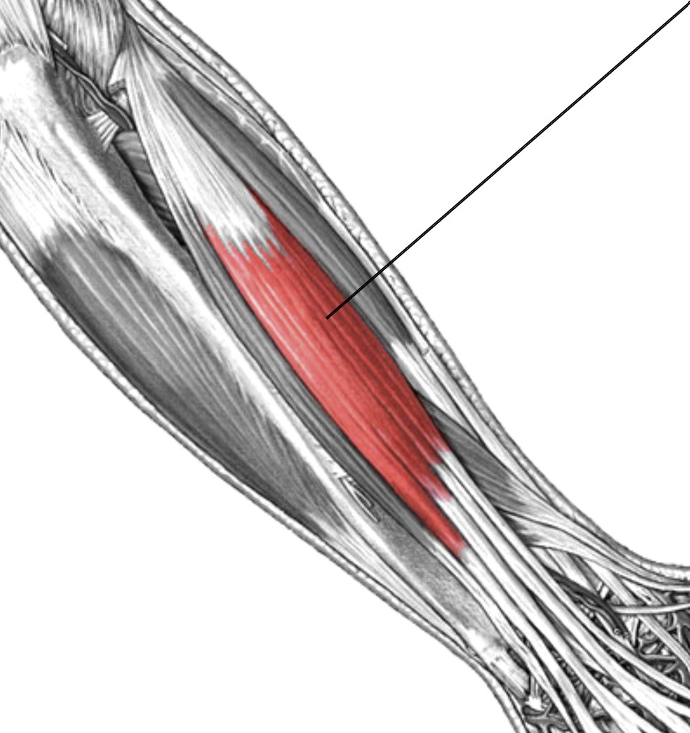 <p>Which muscle of the fingers is:</p><ul><li><p>Attached to four distal phalanges, lateral to extensor carpi ulnaris</p></li><li><p>Action: ext MP joints</p></li><li><p>Nerve: radial</p></li></ul><p></p>