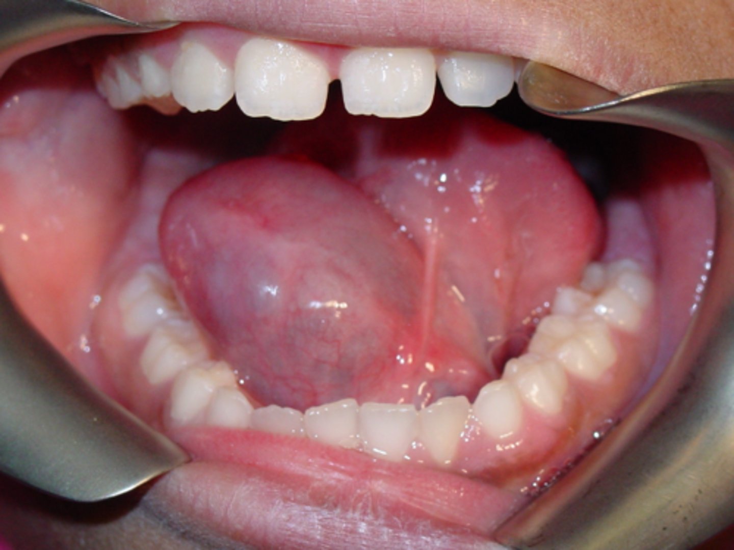 <p>ID the pathology:</p>