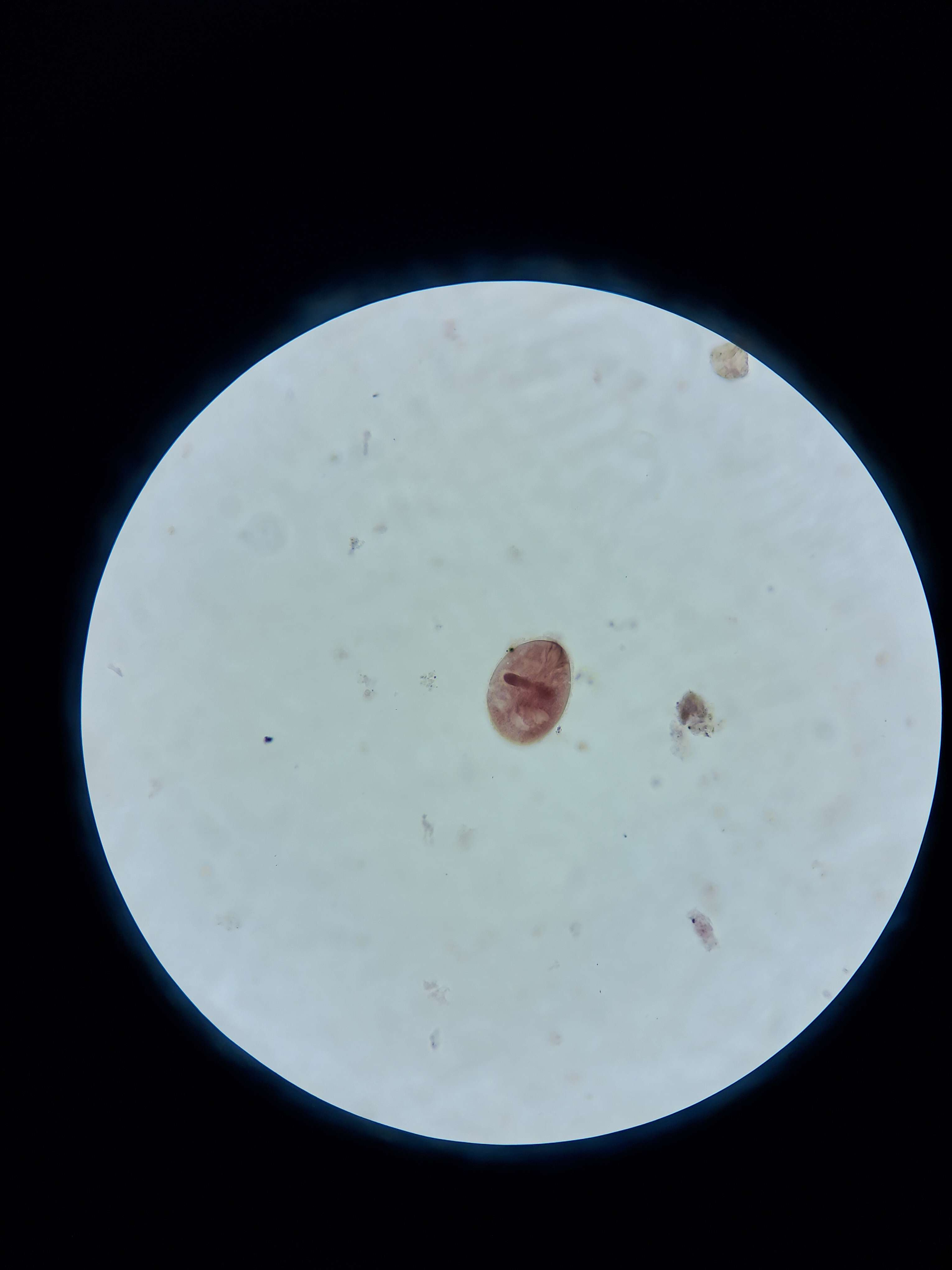 <p><span data-name="microscope" data-type="emoji">🔬</span><span data-name="petri_dish" data-type="emoji">🧫</span><strong><span> </span>Na podstawie zdjęcia preparatu:</strong></p><p></p><ul><li><p><span data-name="book" data-type="emoji">📖</span><span> </span>rozpoznaj gatunek pasożyta;</p></li></ul><p></p><ul><li><p><span data-name="recycle" data-type="emoji">♻</span><span> </span>rozpoznaj wszystkie formy rozwojowe;</p></li></ul><p></p><ul><li><p><span data-name="microbe" data-type="emoji">🦠</span><span> </span>wskaż organelle i cechy charakterystyczne dla danego gatunku;</p></li></ul><p></p><ul><li><p><span data-name="mask" data-type="emoji">😷</span><span> </span>nazwij chorobę, którą pasożyt wywołuje.</p></li></ul><p></p>