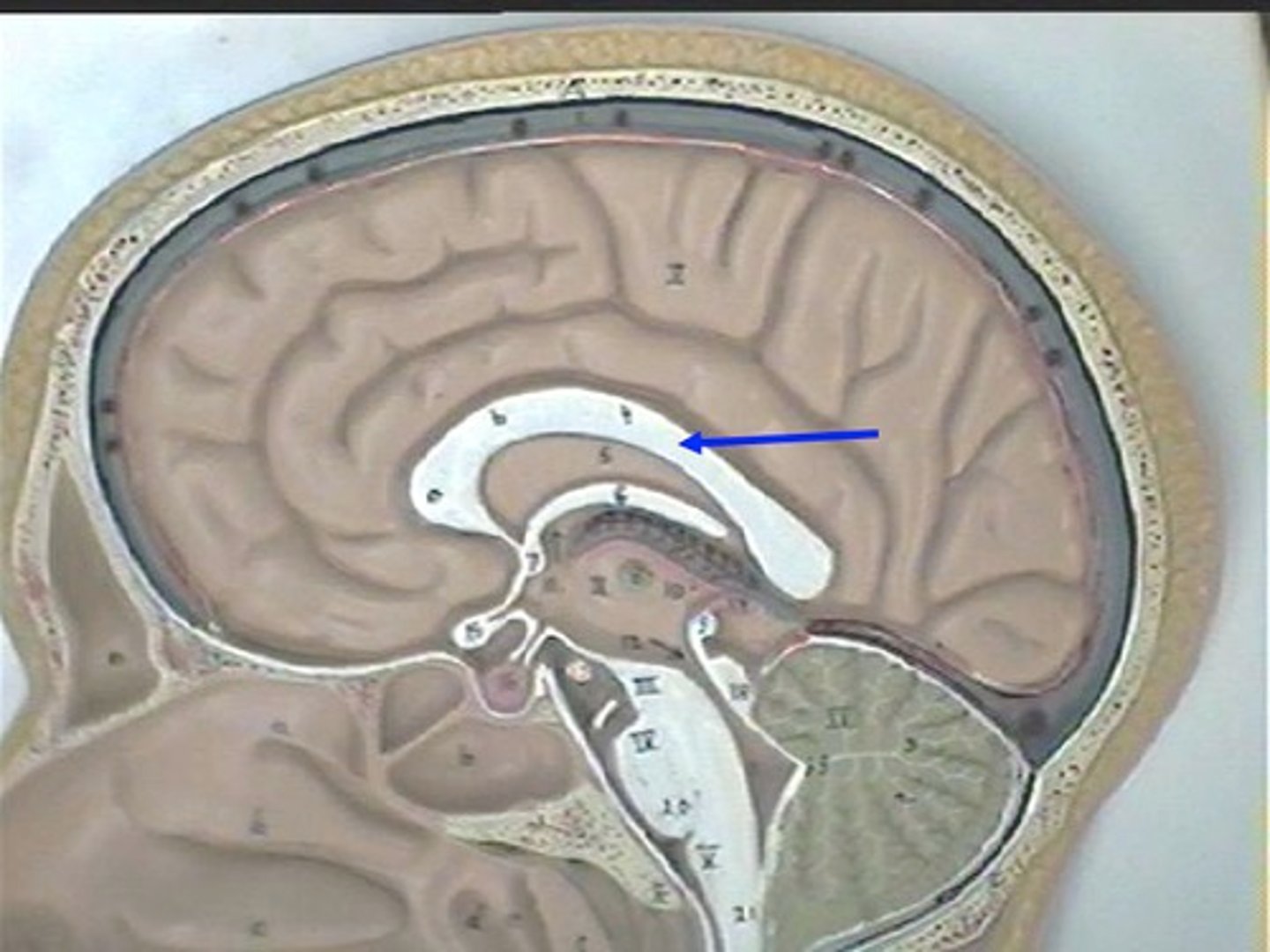 <p>It connects the right and left hemispheres of the brain and allows information to pass between them.</p>