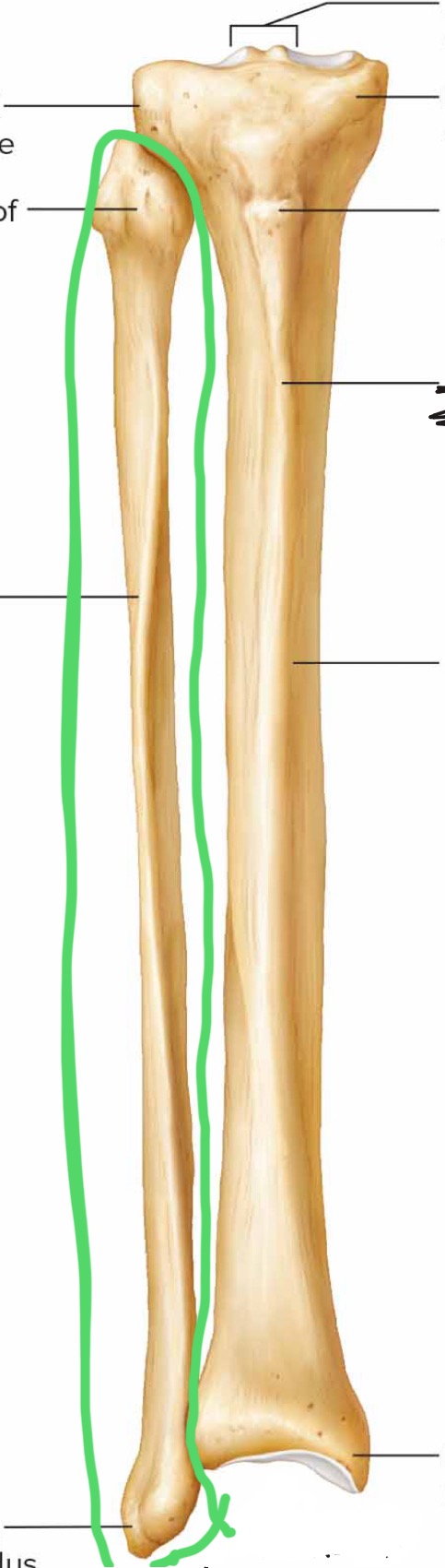 <p>What bone is circled?</p>