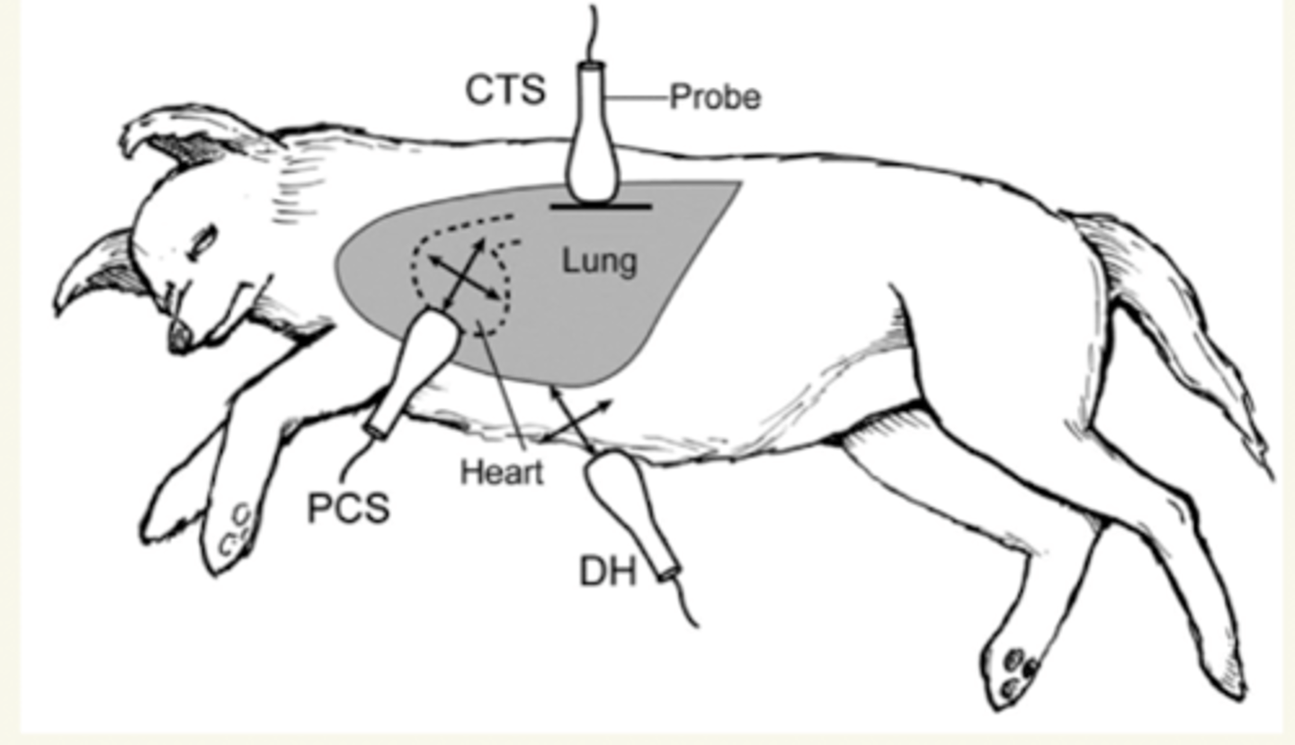 <p>3 puntos:</p><p>1. CTS: área del pulmón</p><p>2. PCS: área del corazón</p><p>3. DH: diafragma-hepático</p>