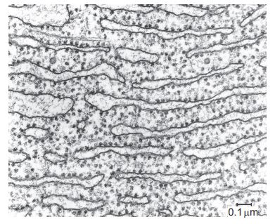 <p>What function is performed by the part of the cell shown in the electron micrograph?</p>