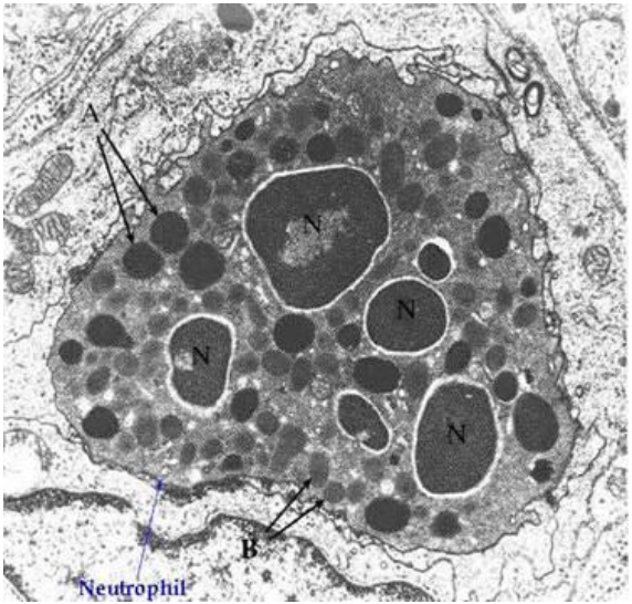 <p><span>What happens immediately after bacteria are phagocytized?</span></p>