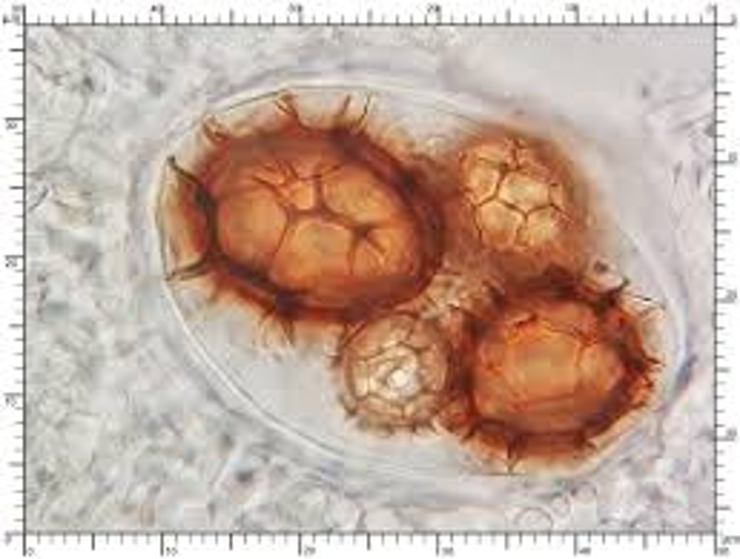 <p>dekstrynoidalny</p>