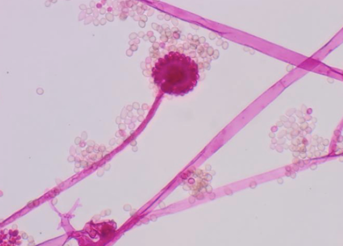 <p>Cunninghamella bertholletiae</p>