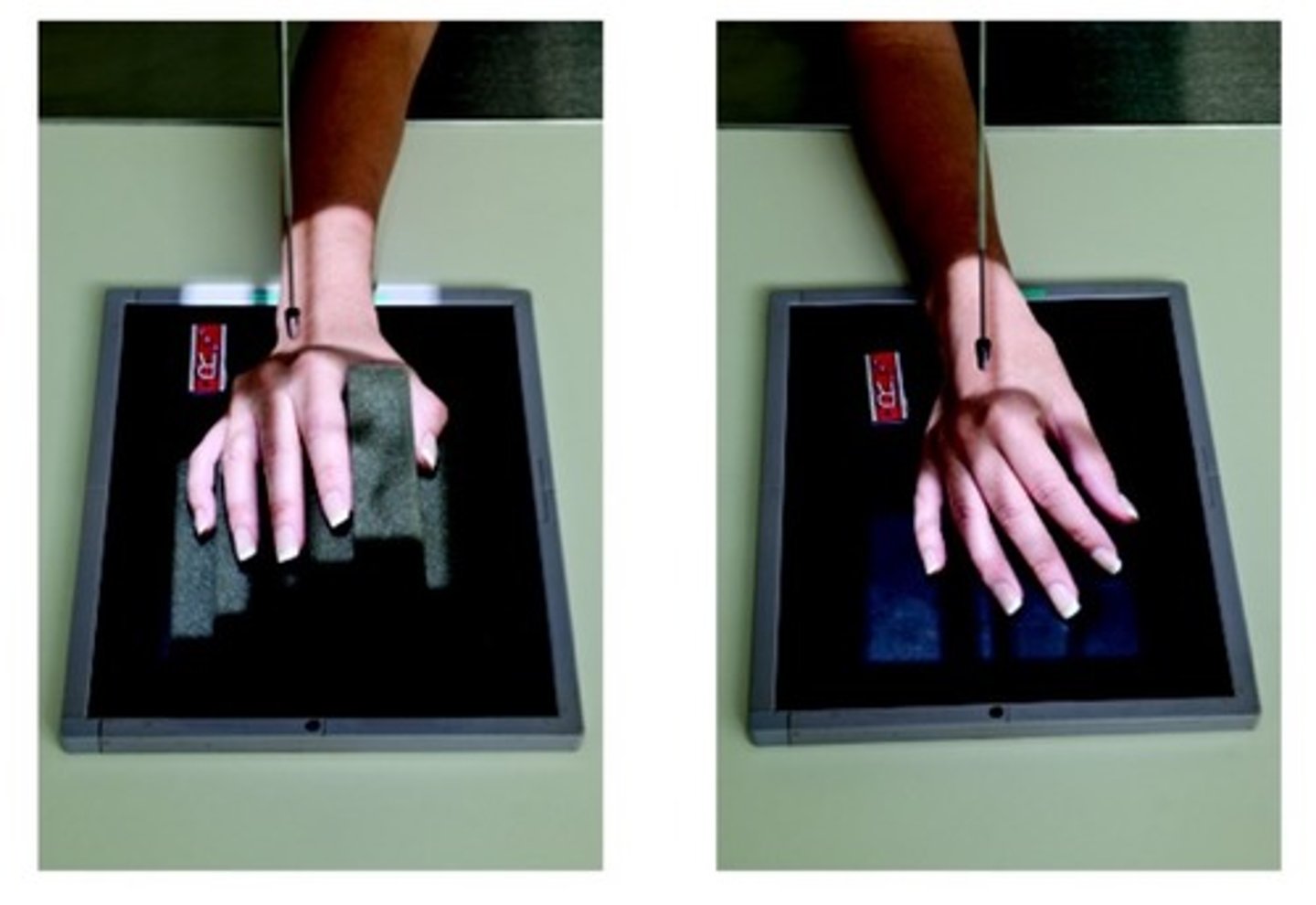 <p>-Entire hand, carpals, and 1" of radius/ulna shown</p><p>-open MCP and IP joints</p><p>-45 degrees of rotation</p><p>-partial superimposition of the third fourth and fifth metacarpal bases and heads</p>