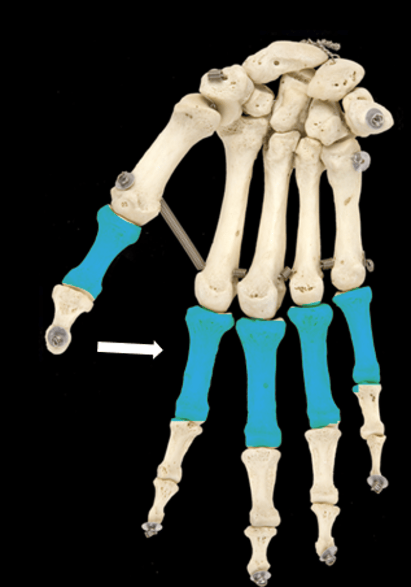 <p>name the part</p>