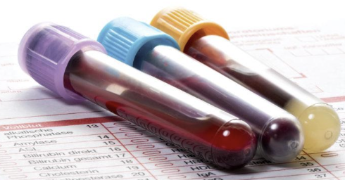 <p>anemia and thrombocytopenia are common</p>