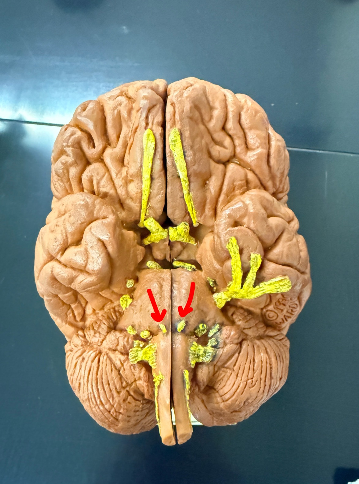 <p>Name the cranial nerve on the brain model</p>
