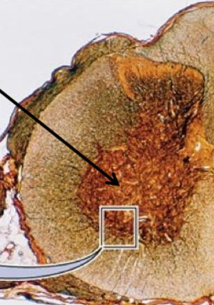 <p>WHAT MATTER OF THIS CROSS CUT SECTION?</p>