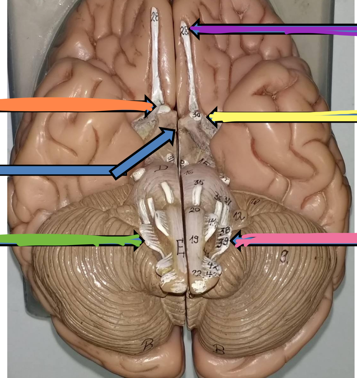 <p>Green AND Pink point to what cranial nerve&nbsp;</p>