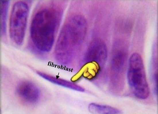 <p>fibroblast</p>