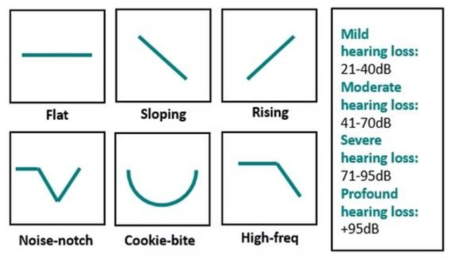 <p>A pattern where a child may miss consonant sounds critical to understanding speech.</p>