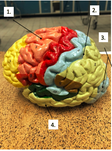 <p>What lobe is #1?</p>