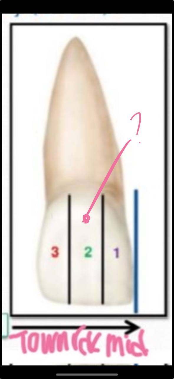 <p>what division is this in the thirds-mesio-distally (crown)</p>