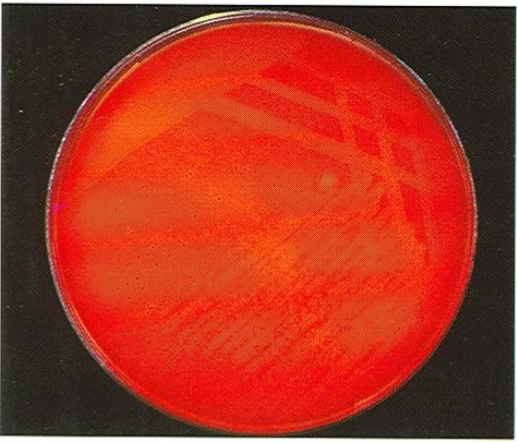 <ol><li><p><em><u>SN</u></em></p></li><li><p>Media</p></li><li><p>Hemolytic/Non hemolytic?</p></li><li><p>Incubation Time </p></li></ol><p></p><p></p>