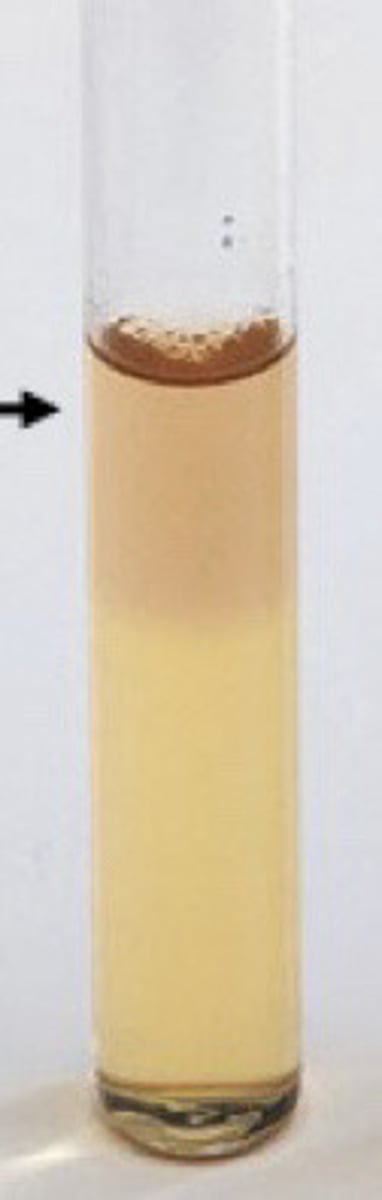 <p>Pink = oxygen present; colorless = no oxygen</p>