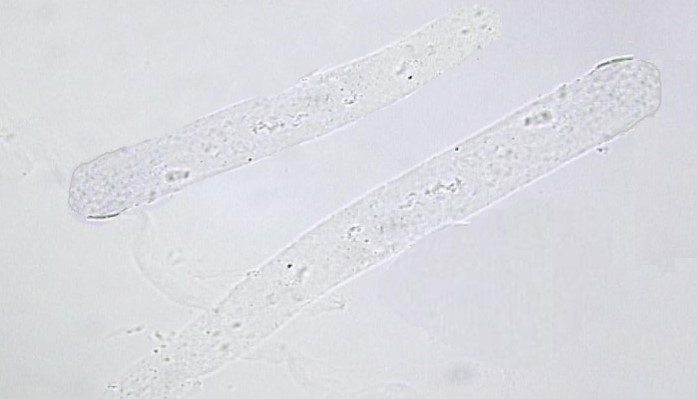 <p>Name this cast? What is it associated with?</p>