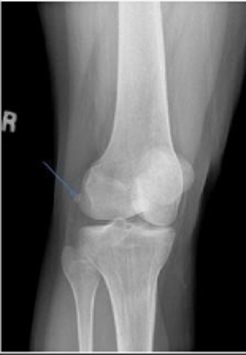 <p>What is radiographic view?</p>
