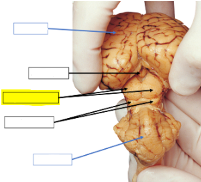 <p>what structure of the sheep brain is highlighted in yellow?</p>