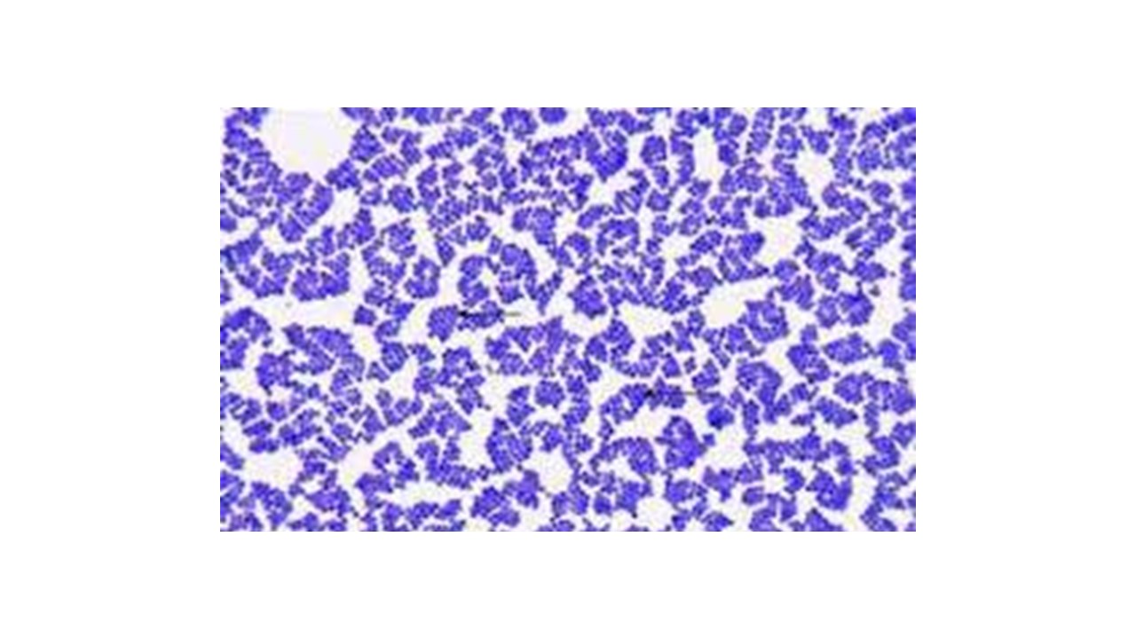 <p>gram positive&nbsp;</p>
