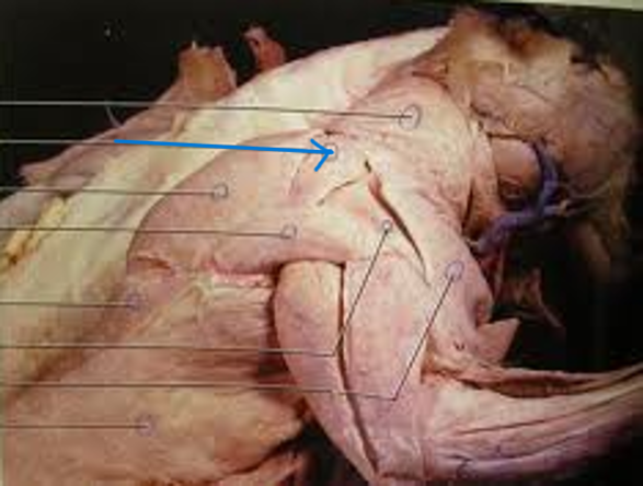 <p>What is the muscle indicated by the arrow? What is an attachment point and function?</p>