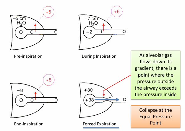 <p>-airway closure at the equal pressure point</p>