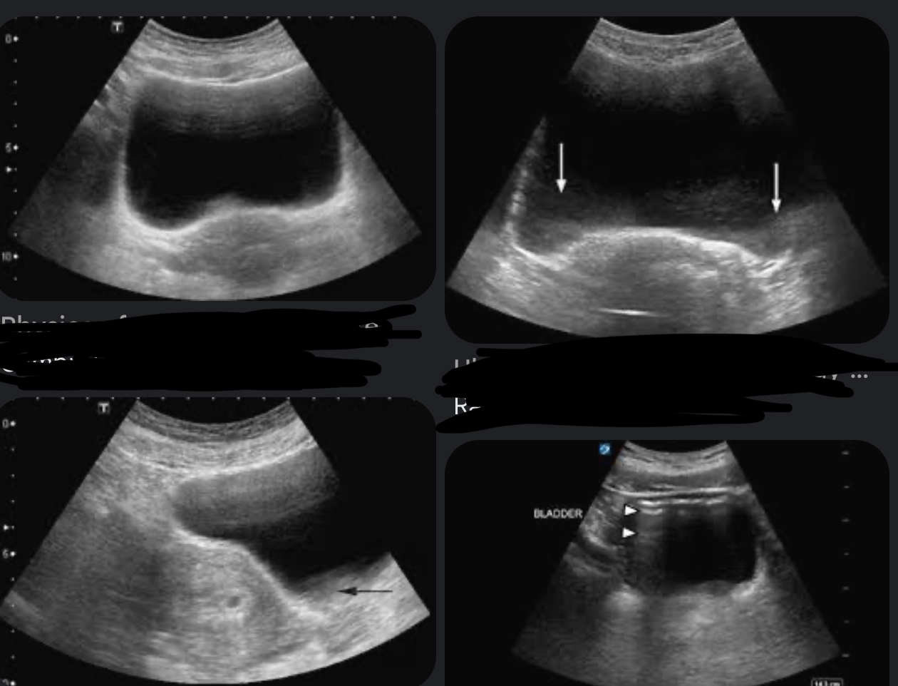 <p>Which assumption is failed in section thickness &amp; how do we fix it ?</p>