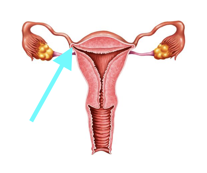 <p>What structure is shown?</p>