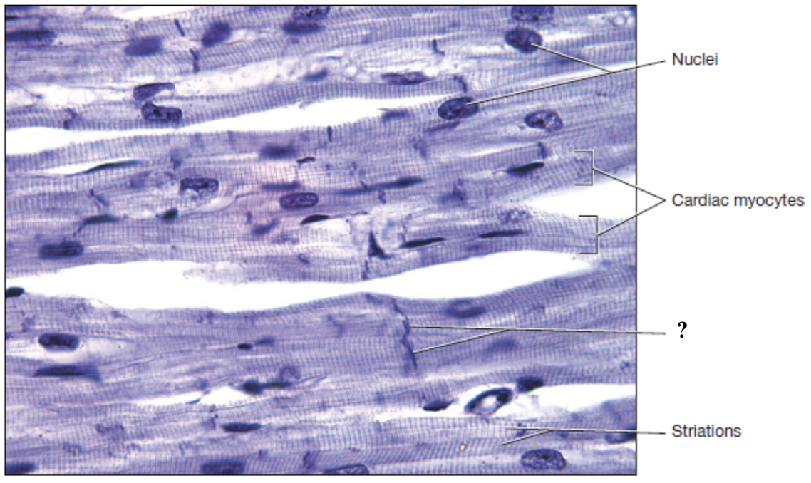 <p>specialized structures that contain desmosomes and gap junctions which enable the heart to contract as one coordinated unit</p>