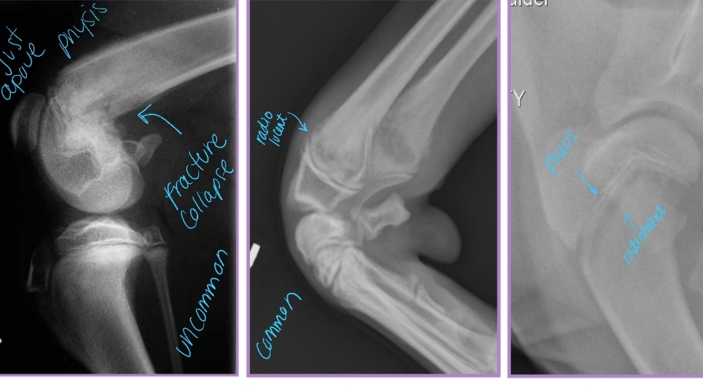 <p><span style="background-color: transparent;"><strong><span>Hypertrophic Osteodystrophy (HOD)</span></strong></span></p>