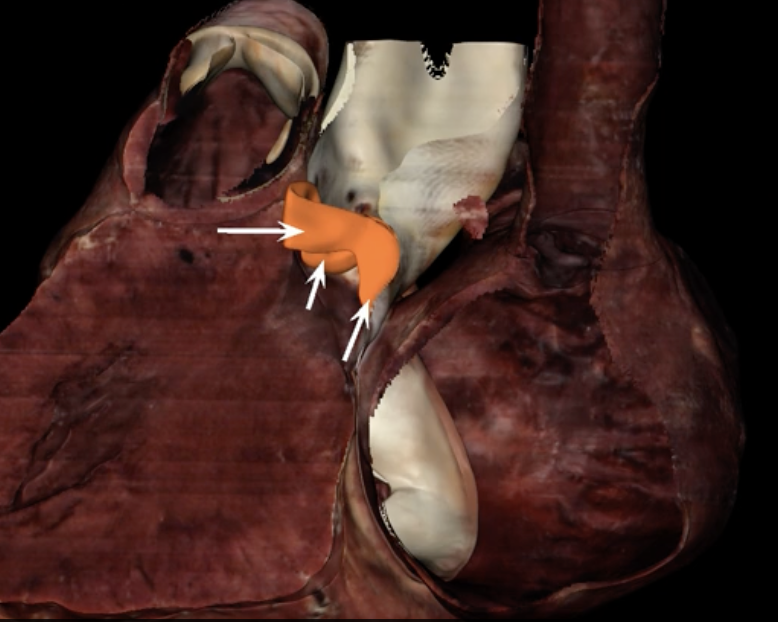 <p>What are the arrows pointing to?</p>