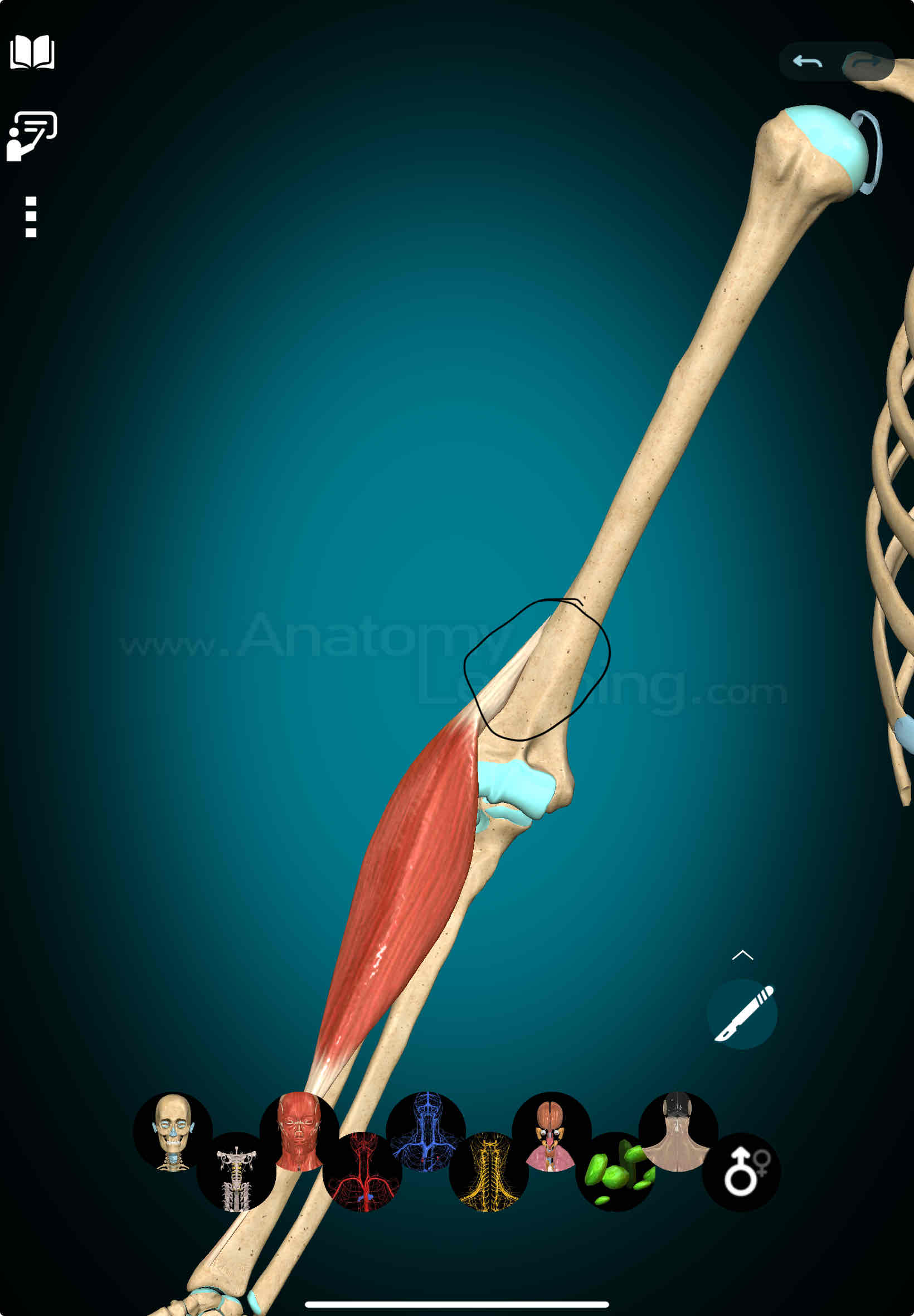 <p>Brachioradialis Origin</p>