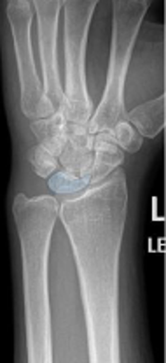 <p>What is outlined?</p>