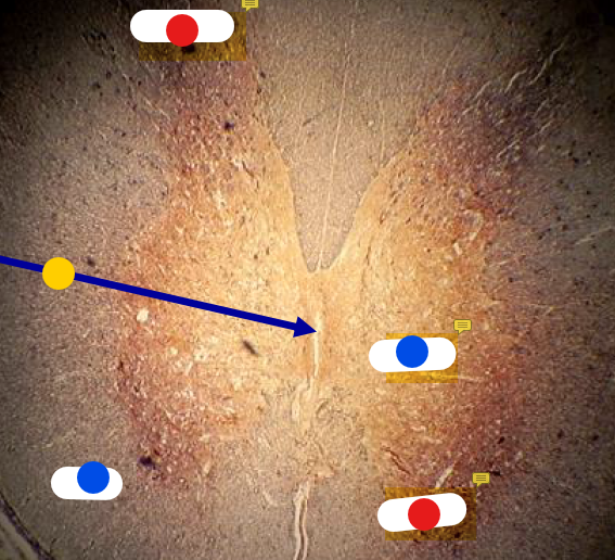 <p>Identificación en Médula Espinal</p>