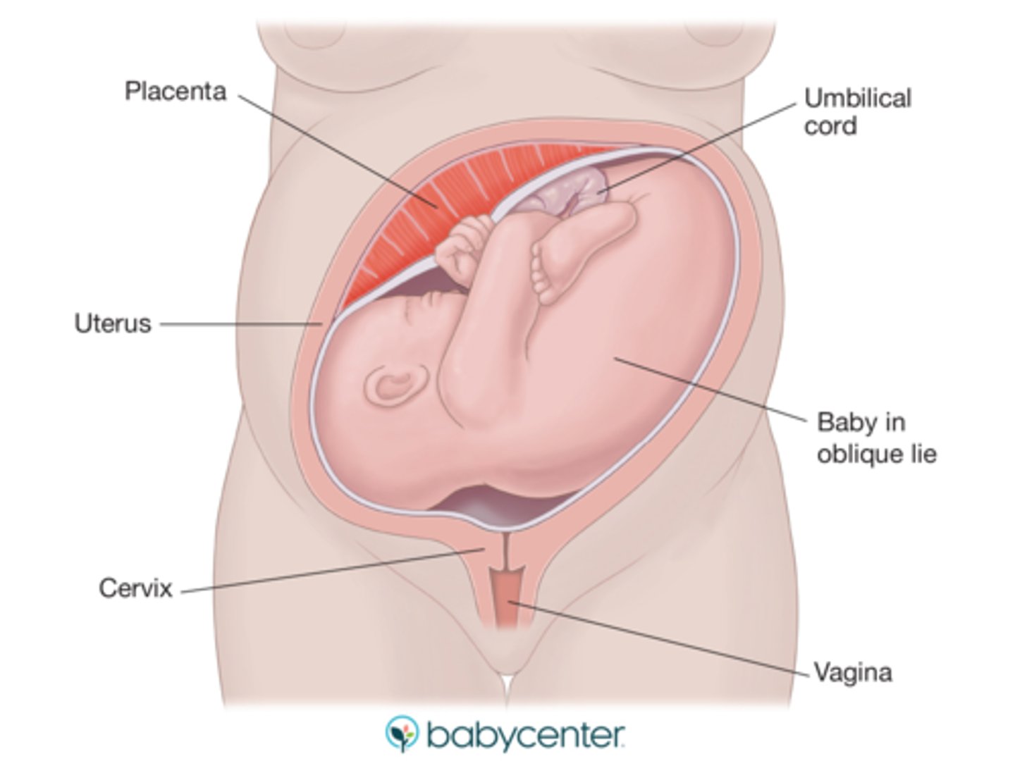 <p>lying at an angle to the mother and converts to transverse or horizontal during labor</p>