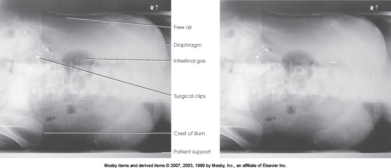 <p>What position is demonstrated?</p>