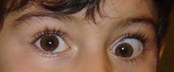 <p>This is a picture of the following condition:</p>