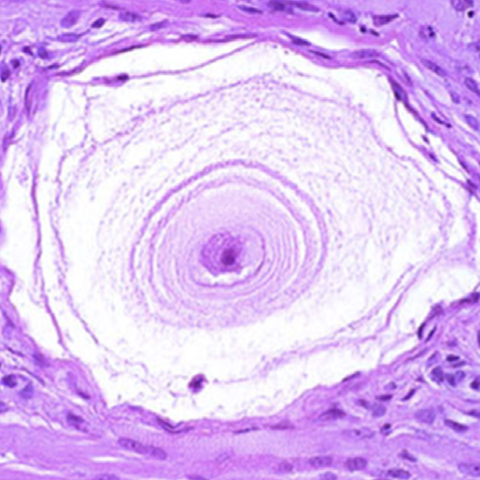 <p>What is this picture demonstrating? </p>
