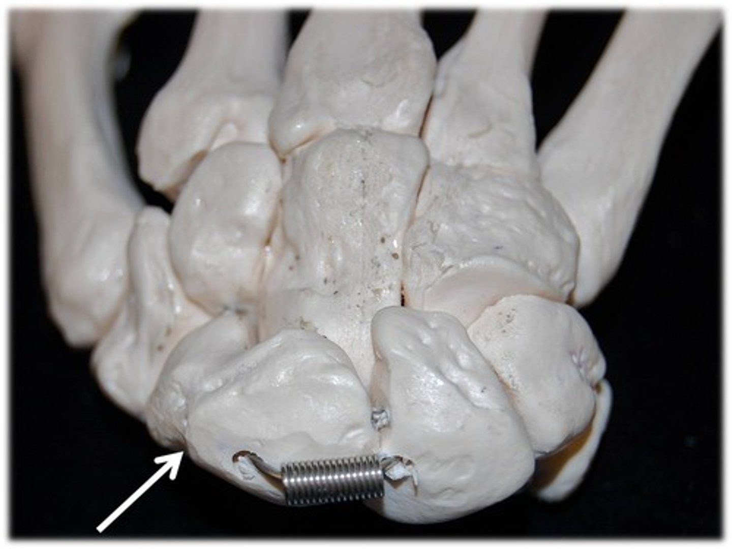 <p>Name this specific bone of the hand (posterior view).</p>