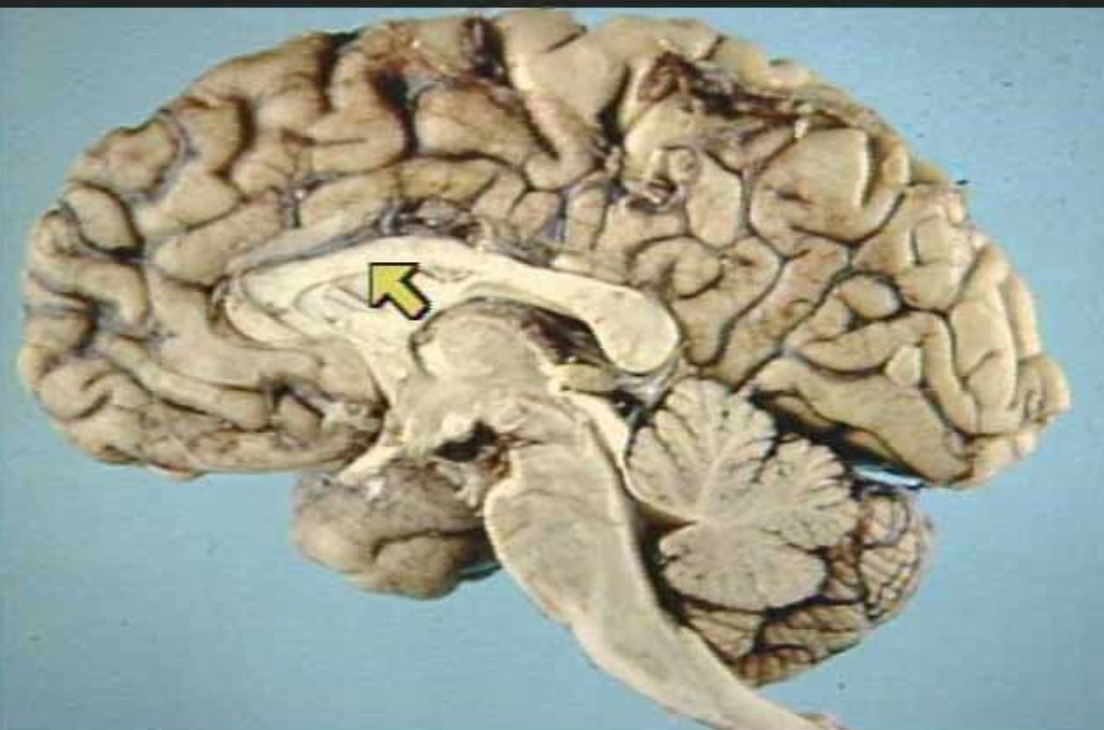 <p>What is the arrow pointing at?</p>