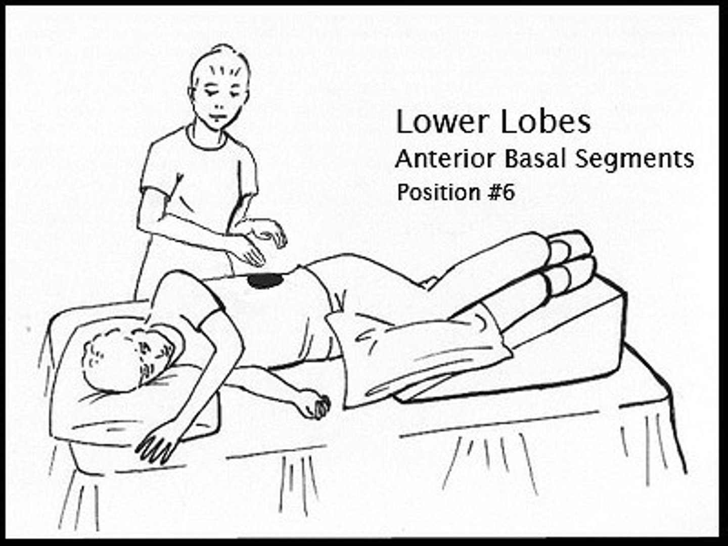 <p>*Patient position*: table elevated 20''. Patient lays down on side, pillow under knees.</p><p>*PT*: percussion over lower ribs.</p>