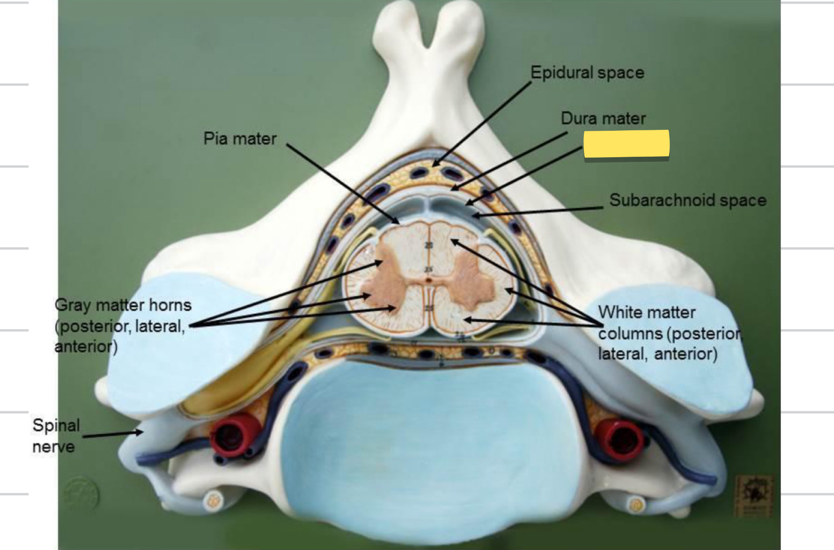 <p>Name this spinal cord part</p>