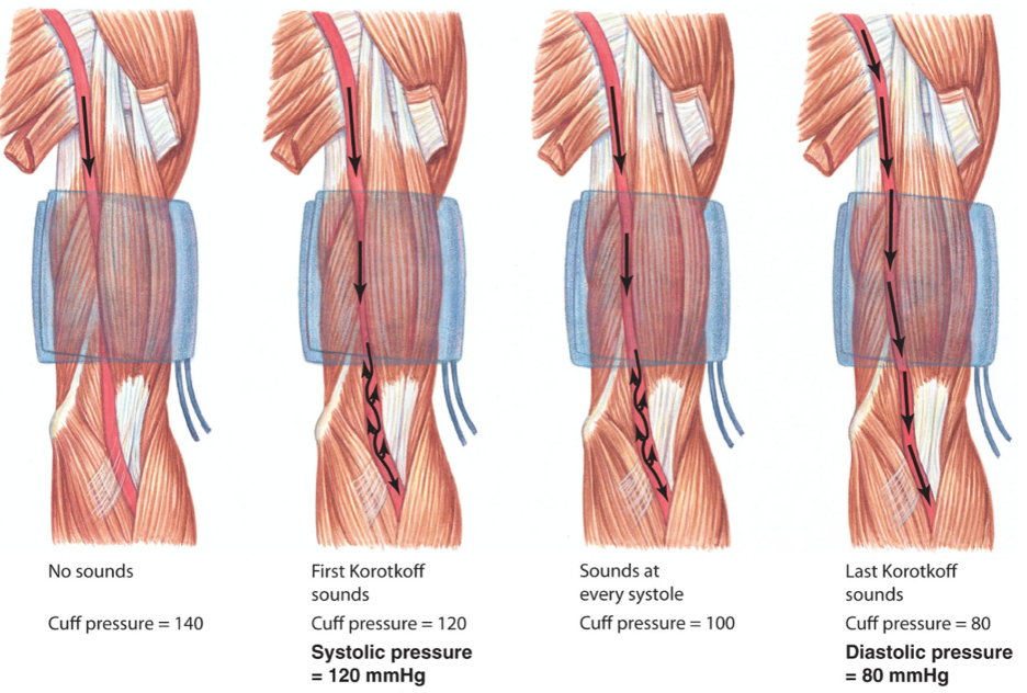 Pressure at which blood can first get past cuff (i.e. when blood is at highest pressure) gives systolic pressure
