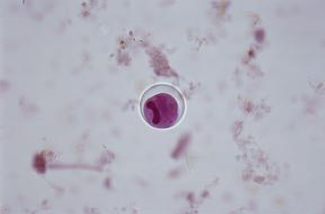 <p>Identify: Protozoa</p>