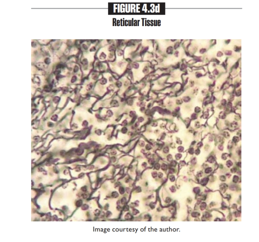 <p>Reticular tissue</p><p></p>