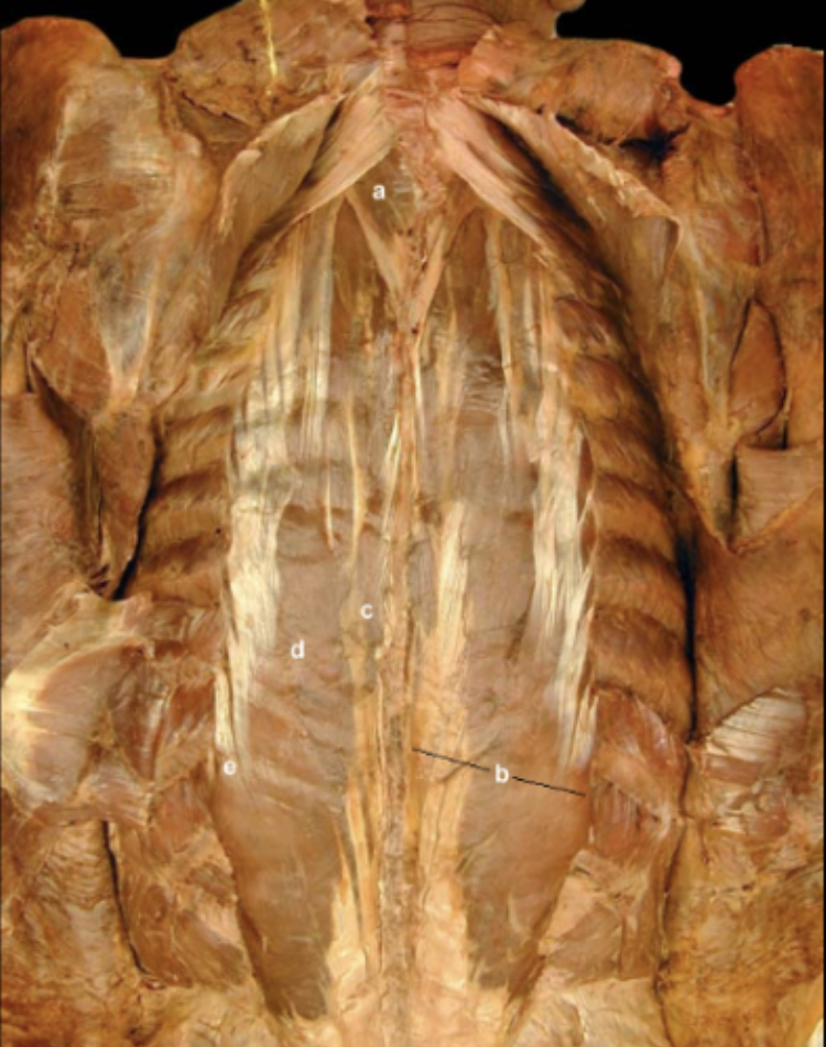<p>Erector Spinae Muscles</p>