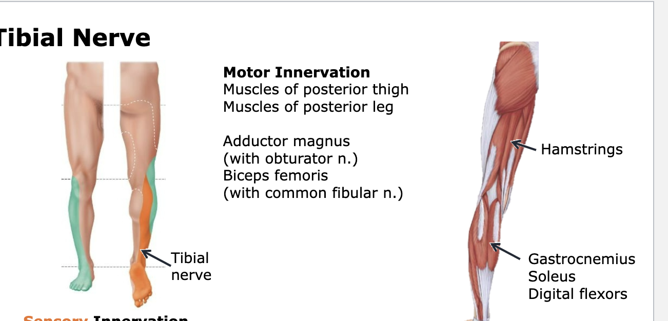 <p>Tibial</p>